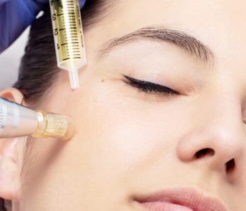 Revive-Face-Mesotherapy