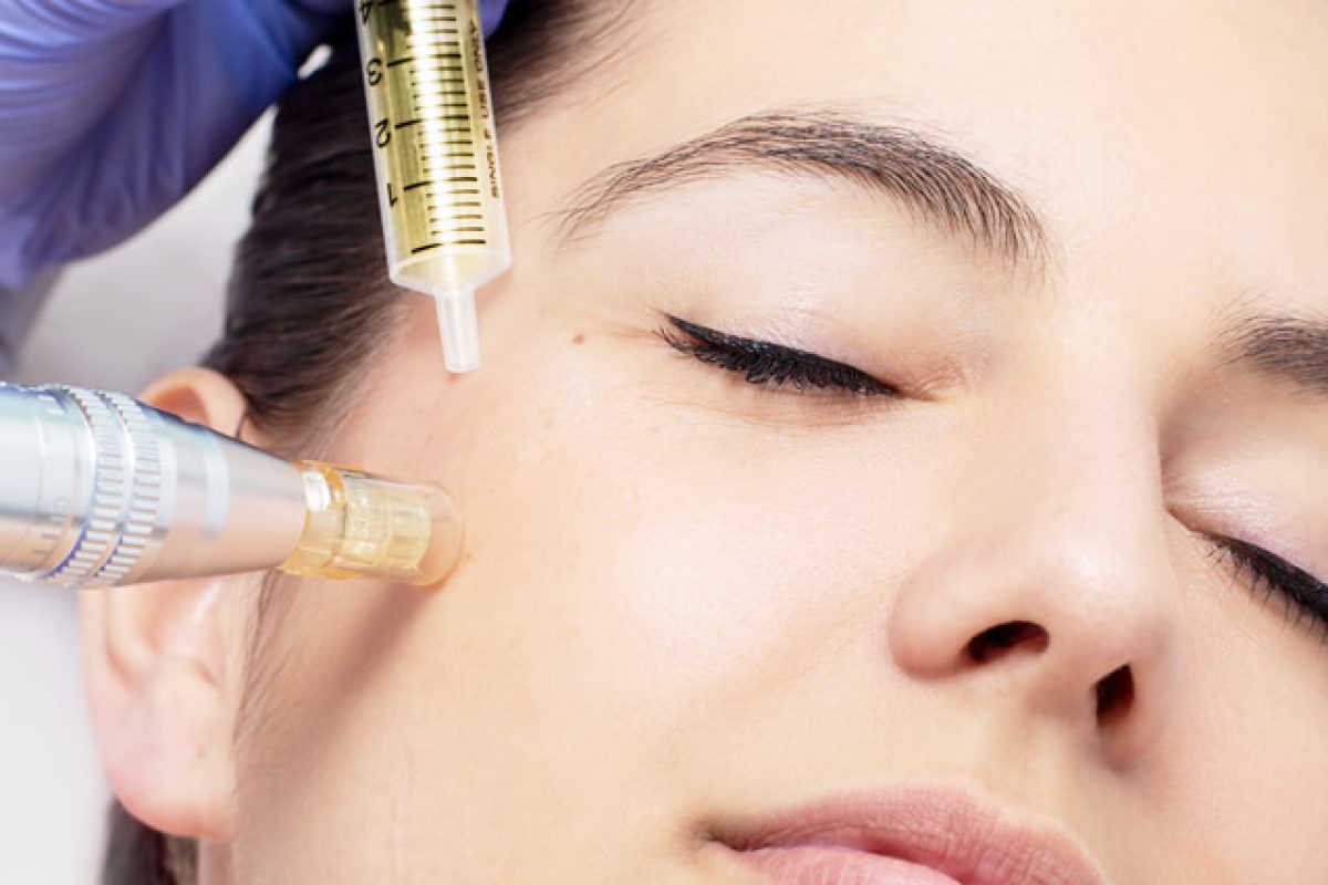 Revive-Face-Mesotherapy