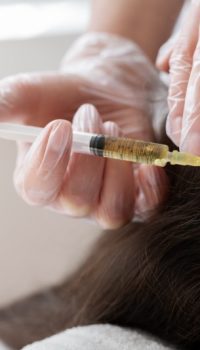 close-up-woman-getting-prp-treatment-1