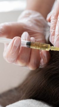 close-up-woman-getting-prp-treatment-1