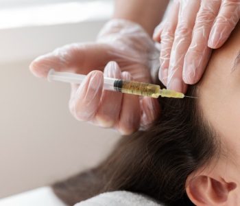 close-up-woman-getting-prp-treatment-1